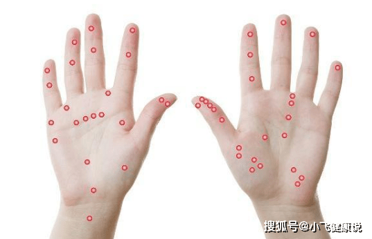 按摩操游戏_团队相互按摩游戏_按摩的手机游戏