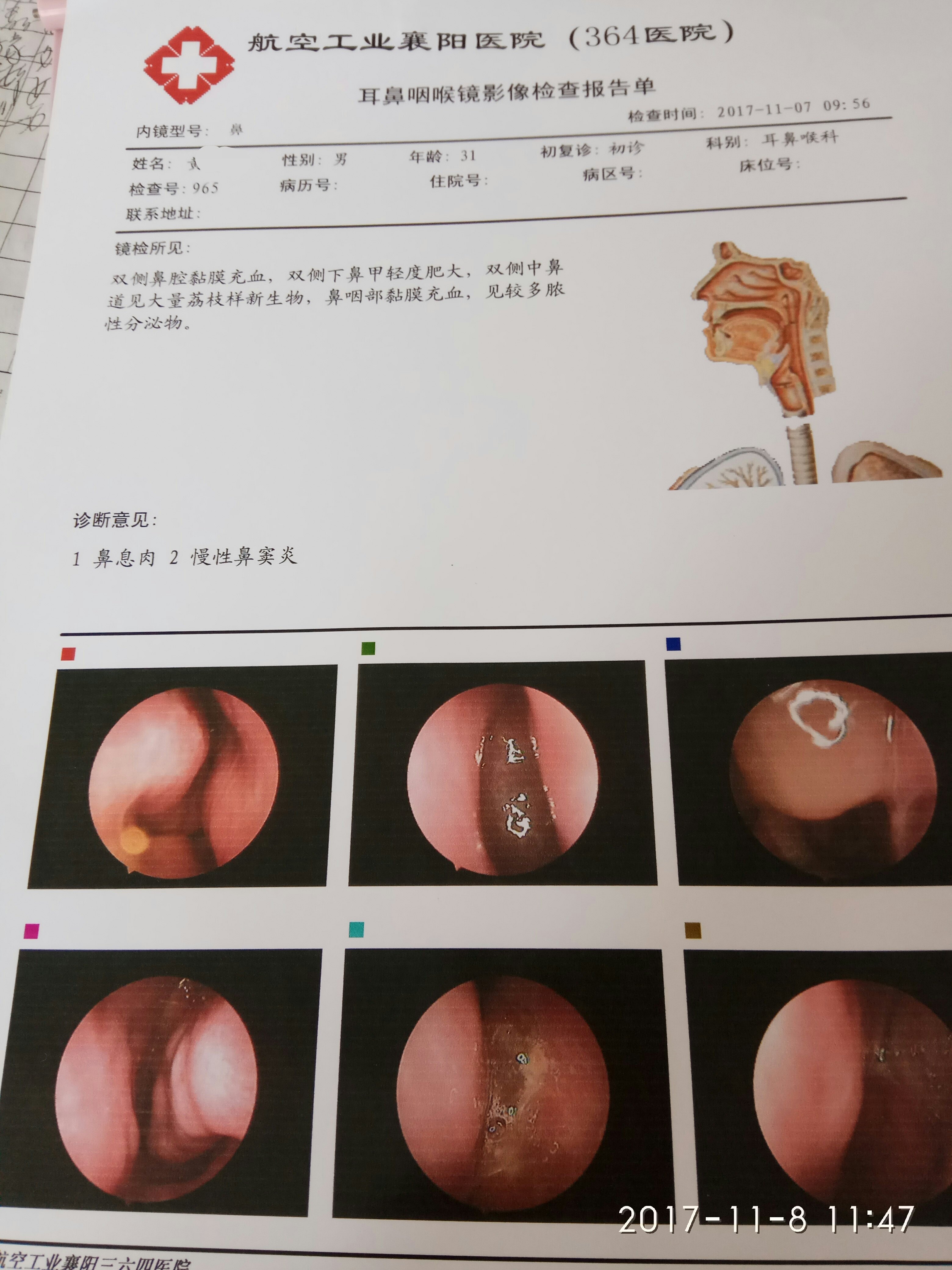 鼻窦炎和玩手机有关系_头晕是玩手机游戏导致的吗_鼻窦炎玩手机游戏头晕吗