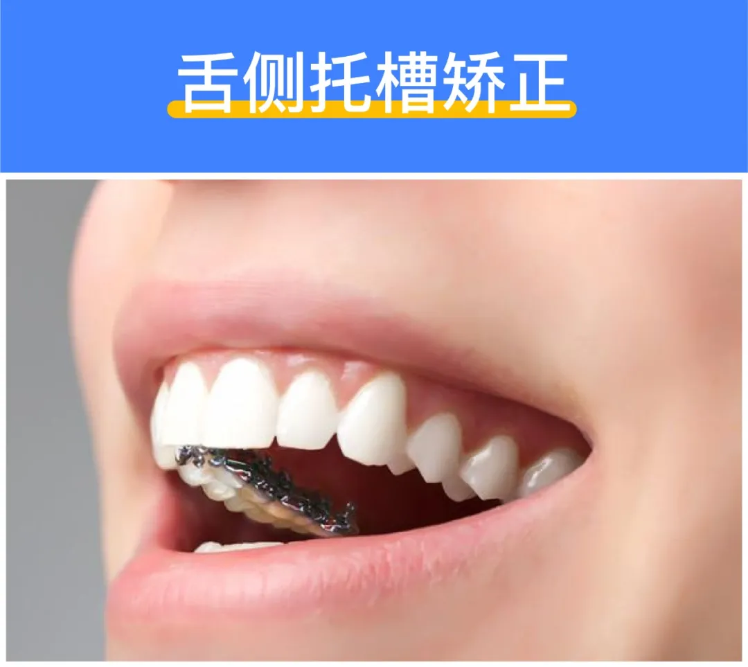 怎么制作视频快进_制作视频快进怎么弄_视频快进怎么制作