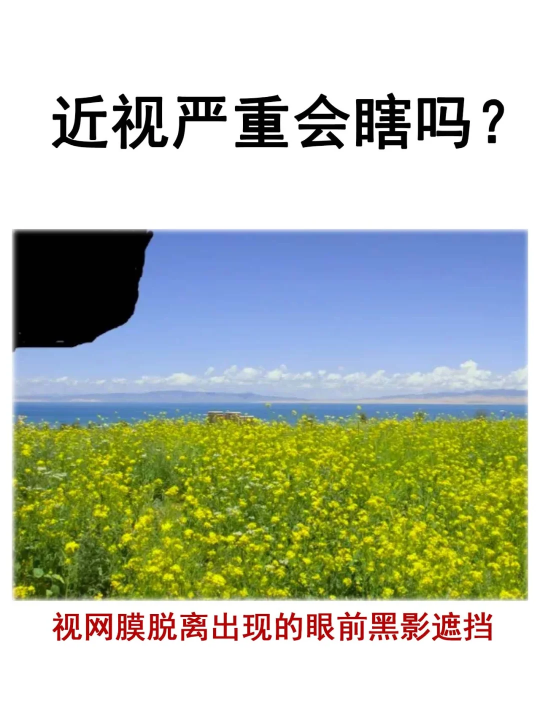近视的人玩手机的注意事项_近视了玩手机会不会加重_高度近视男玩手机游戏女生